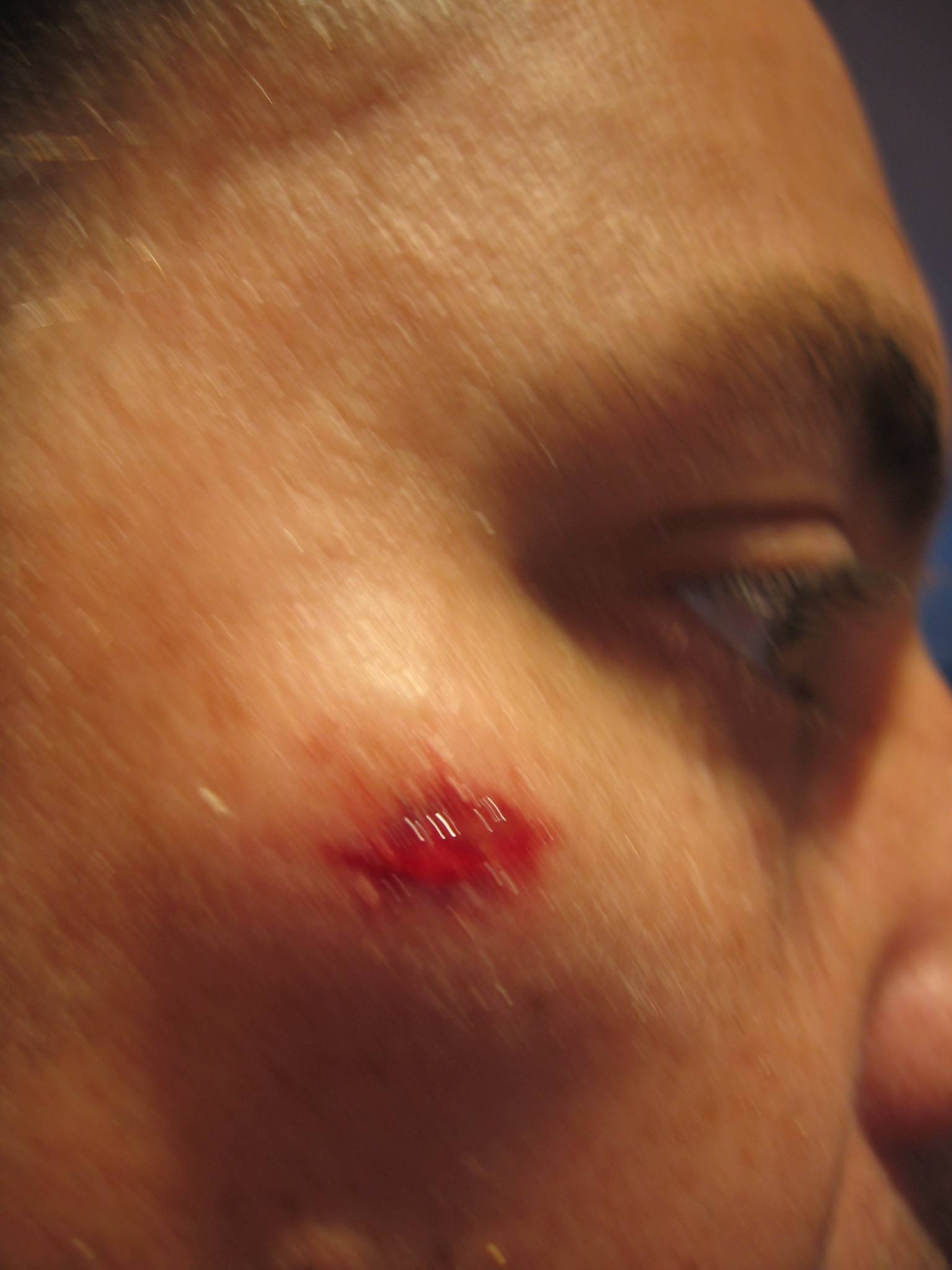 Ouch - lesson learnt in 27kts SW retrieve the board DOWNWIND of myself