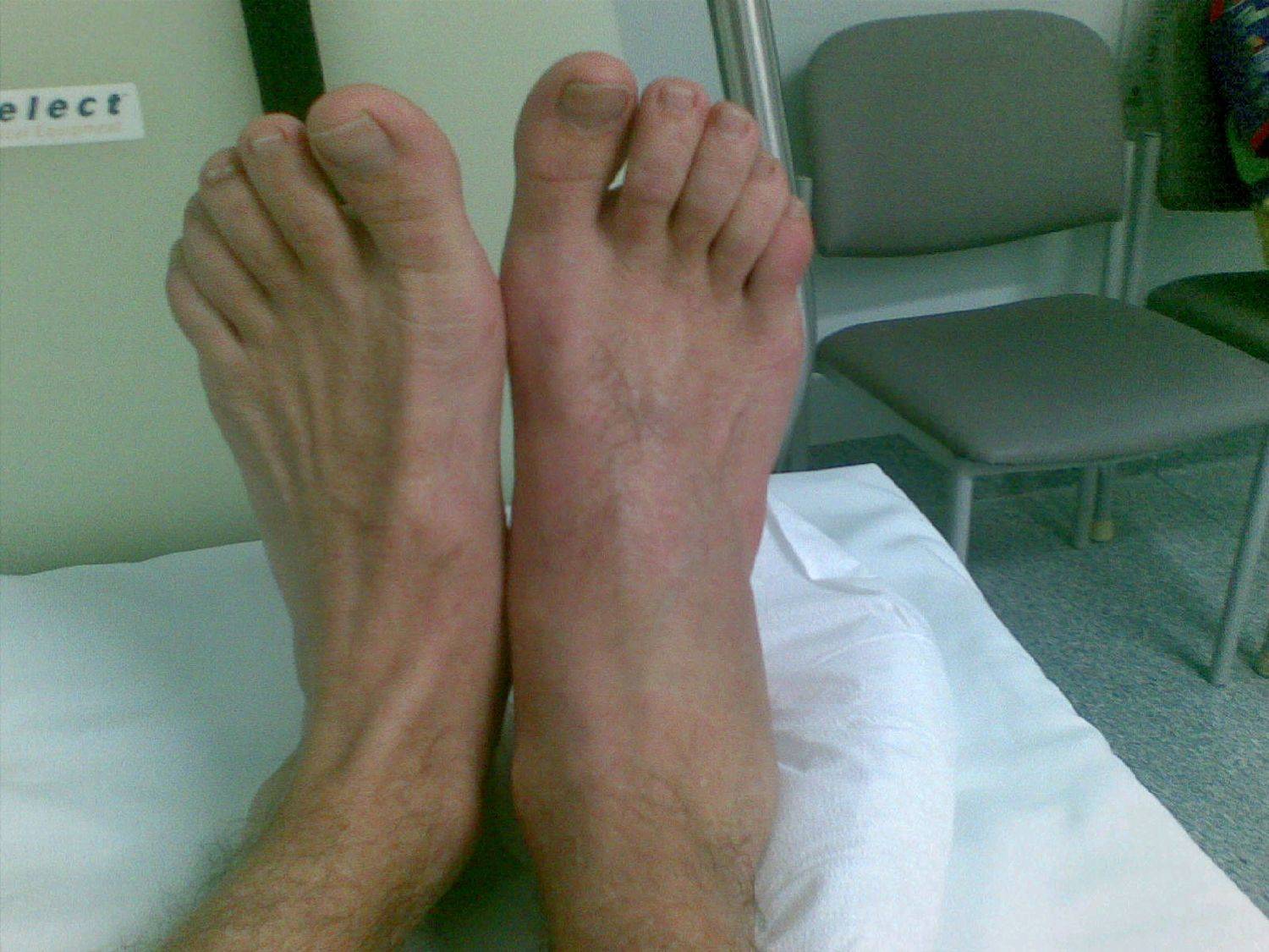 sams foot