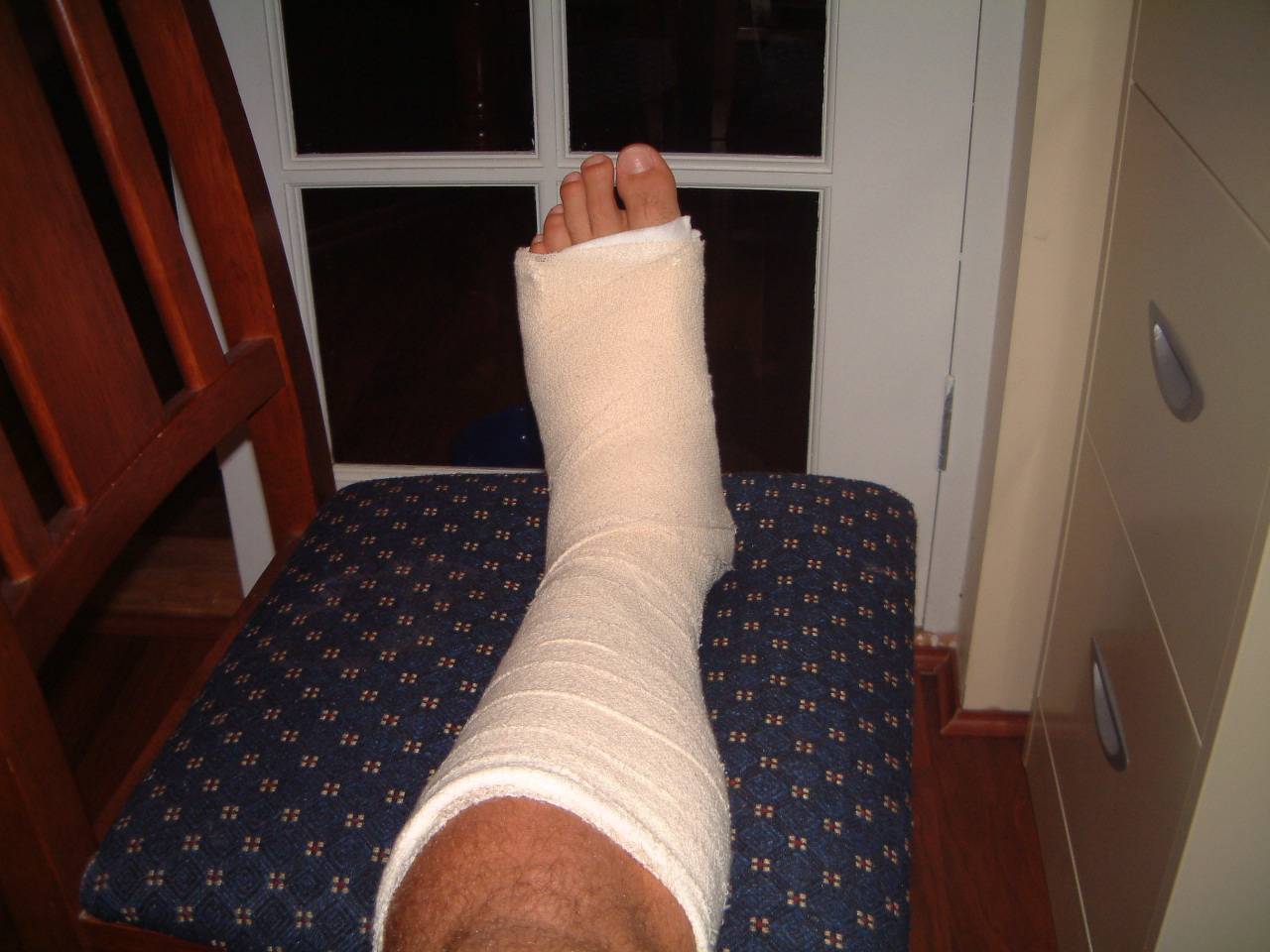 My ankle