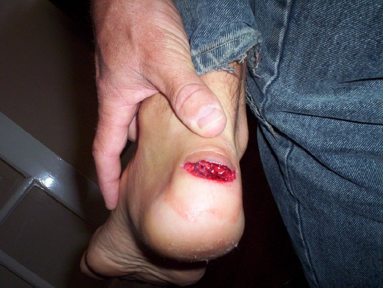 Tenderfoot