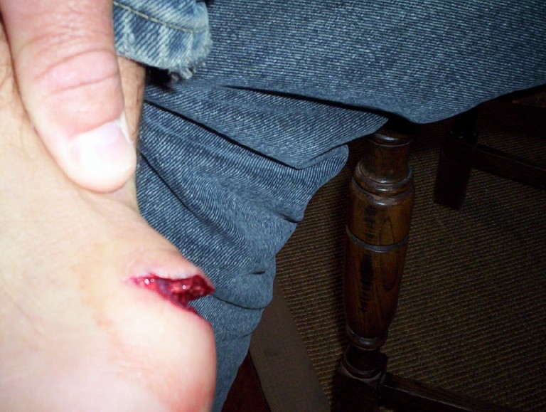 Tenderfoot