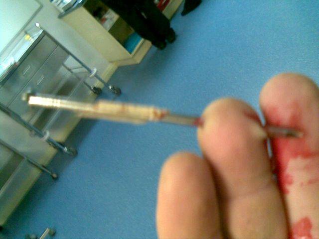 NAIL