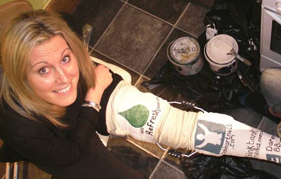 sam-leg-cast