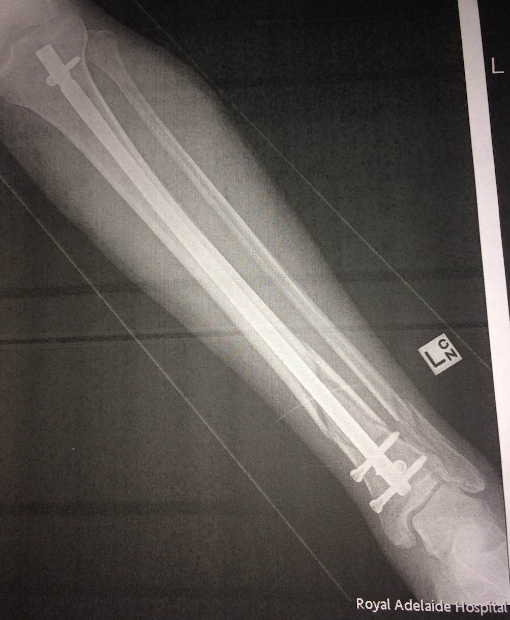 Ouch