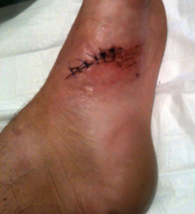 foot