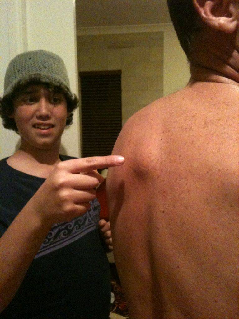 hump