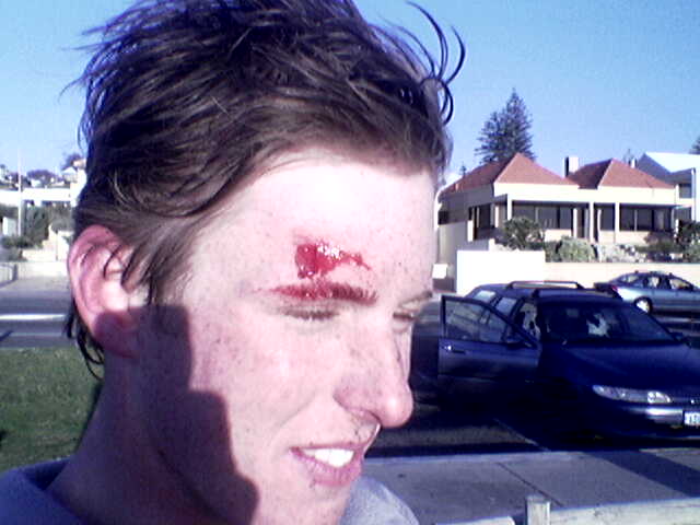 yeh this kinda hurt
