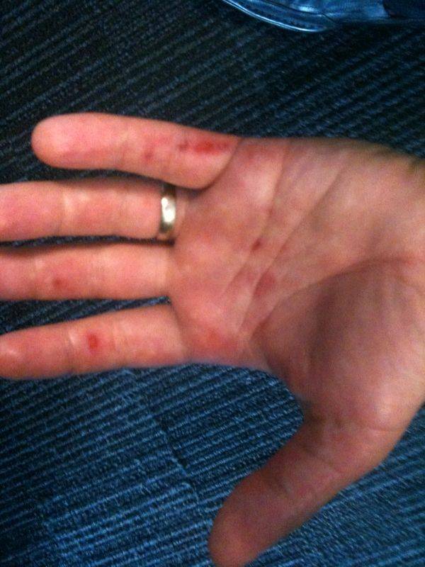 Windsurfer Hands