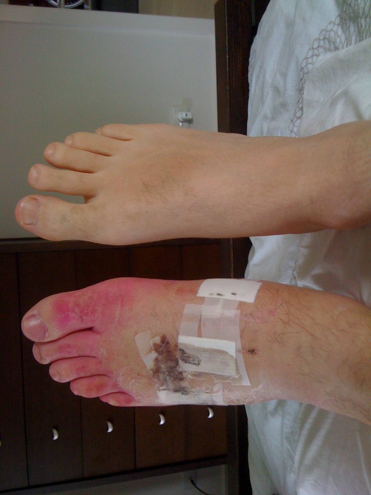 Foot