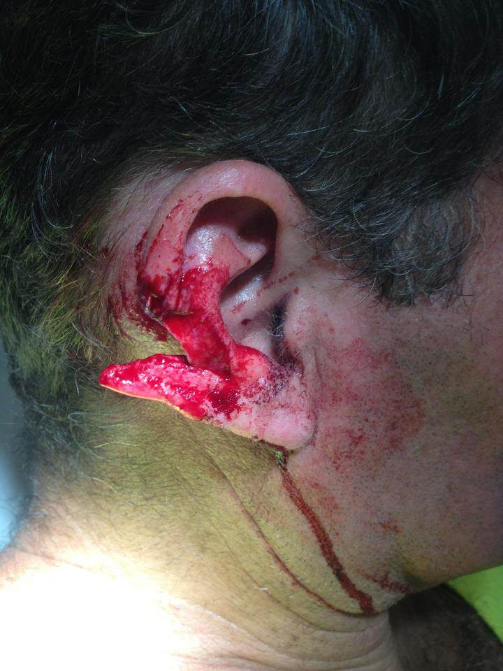 My ear