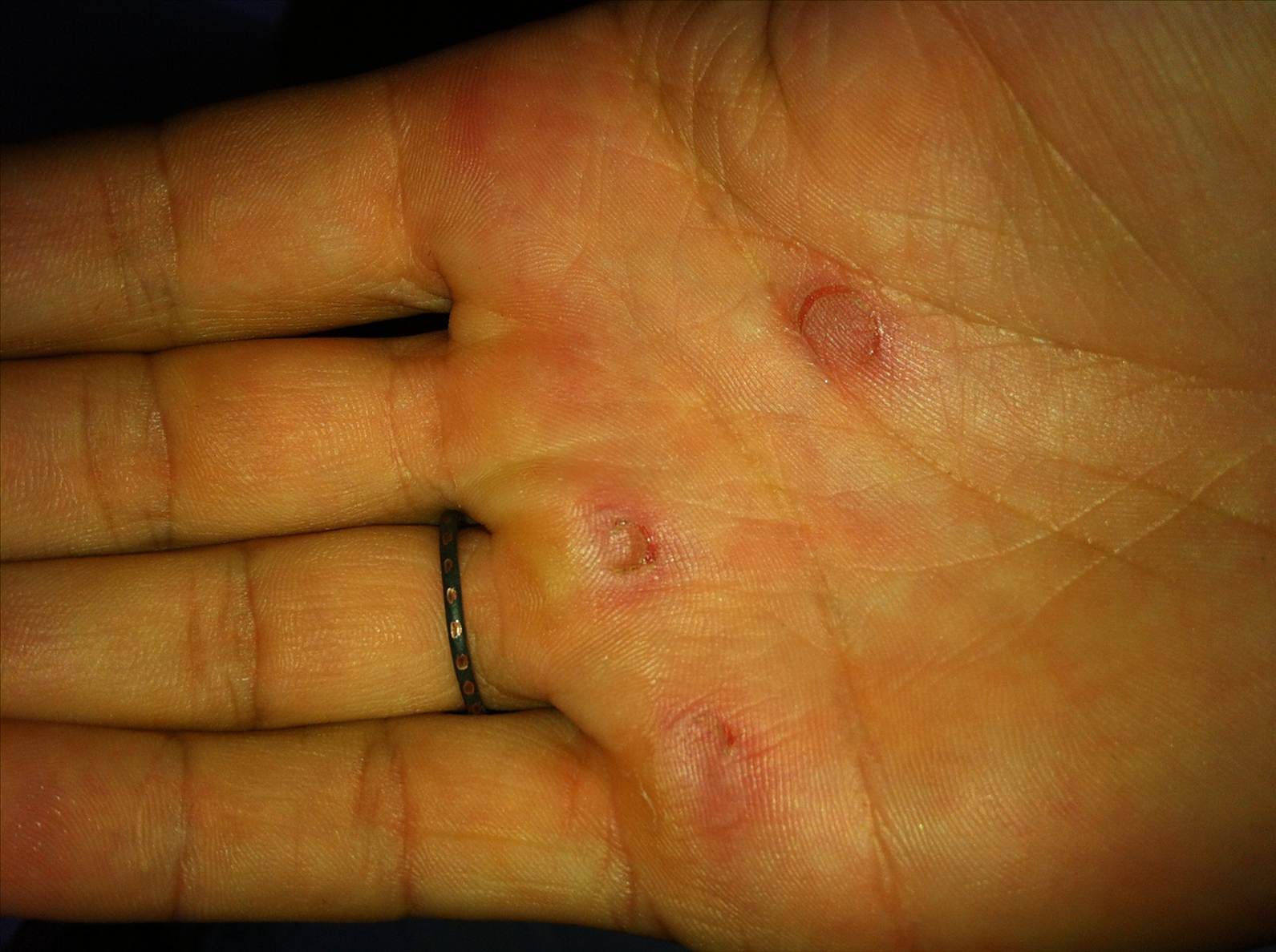 hand2