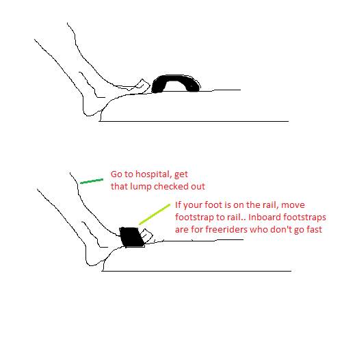 Feet